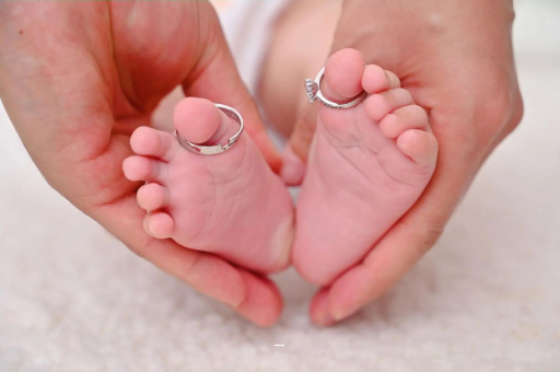 蚌埠孕妇怎样预防妊娠纹